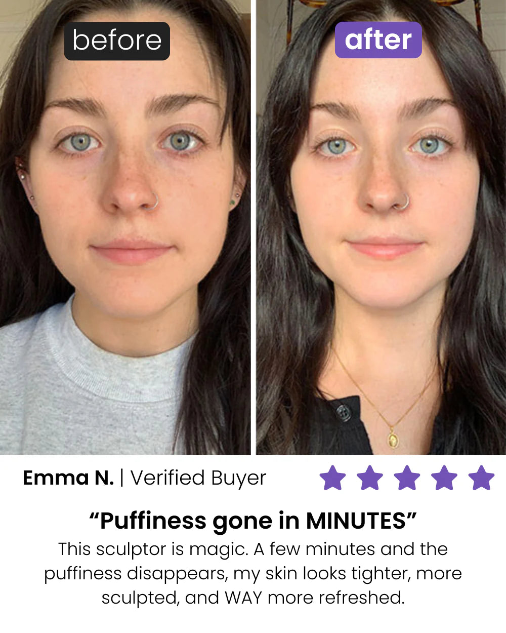 Glow-Boosting Facial Roller