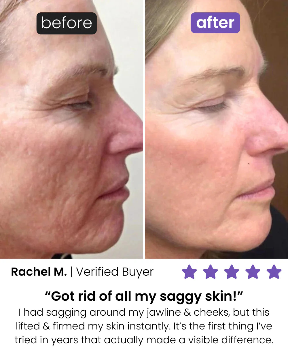 Glow-Boosting Facial Roller