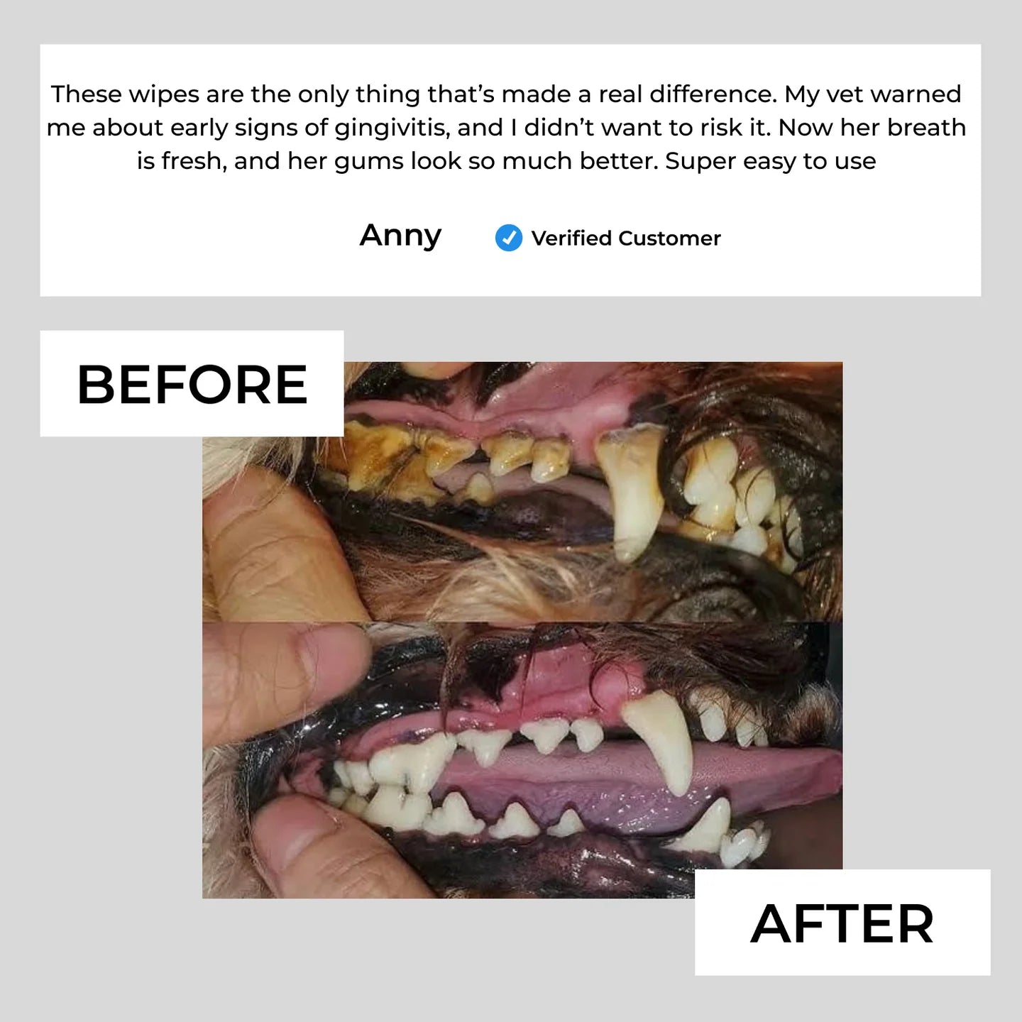 FreshWipes Kit – Protects Against Dental Diseases