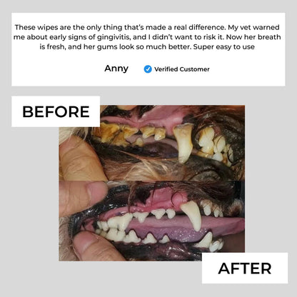 FreshWipes Kit – Protects Against Dental Diseases